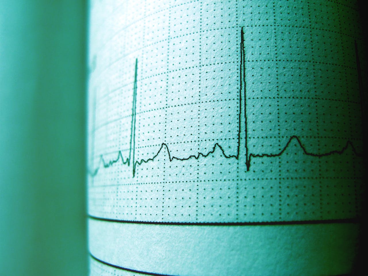 About Close-up of an ECG printout displaying heartbeat rhythm and frequency for medical analysis.